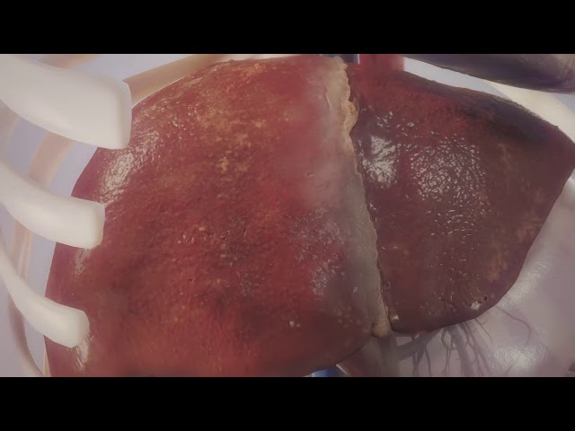 Fat deposition in liver English