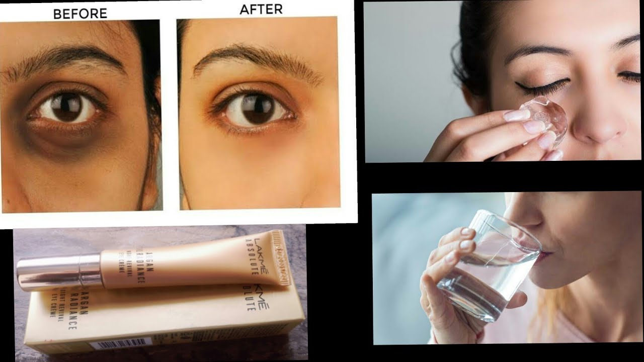TOP 4 TIPS TO REDUCE DARK CIRCLES,PUFFINES,WRINKLES UNDER EYES LAKME