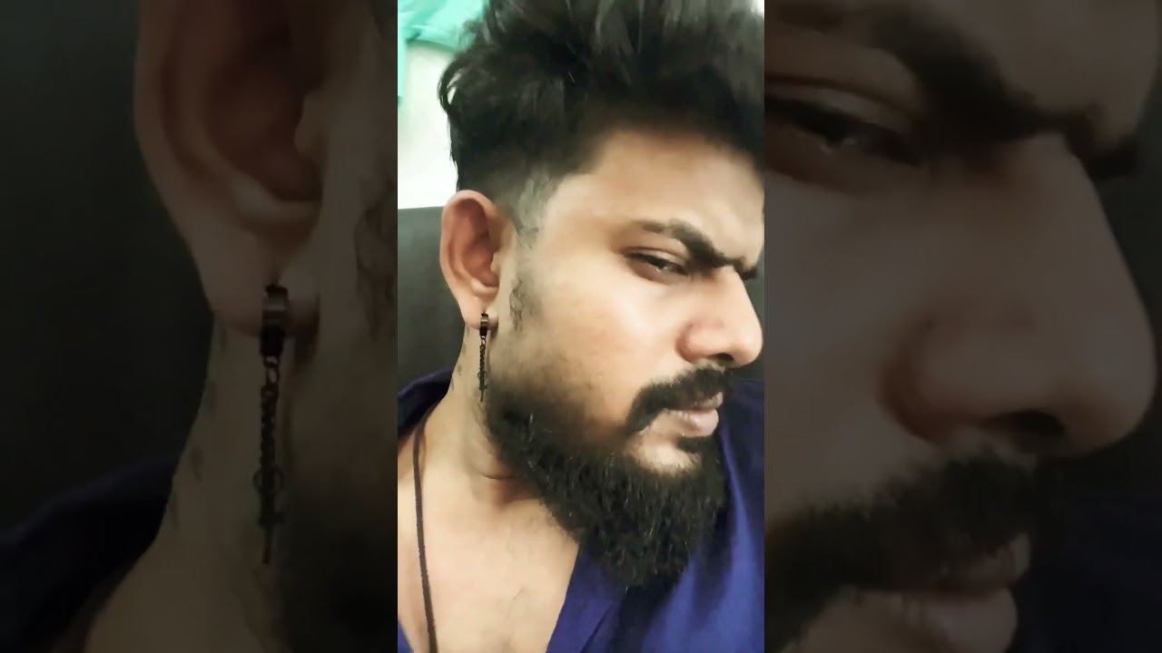 minoxidil after 3 month 