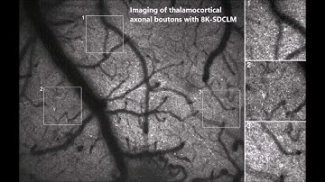 In vivo wide-field calcium imaging of mouse thalamocortical synapses with an 8 K ultra-high