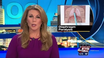VIDEO: Diaphragm paralysis: 