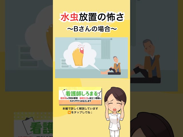【糖尿病】水虫放置で起こった悲劇〜Bさんの場合〜
