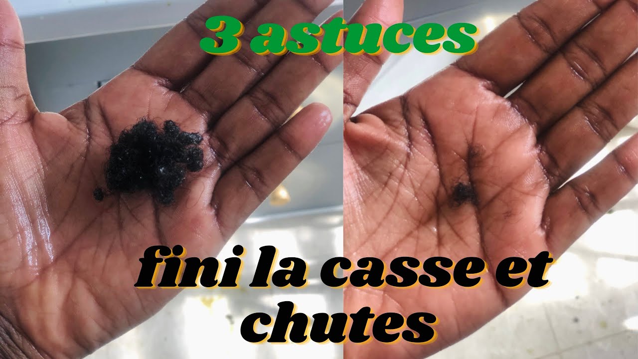 3 ASTUCES QUI STOPPERONT IMMÉDIATEMENT LA CASSE ET CHUTE DE CHEVEUX — free download