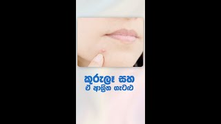 මුහුනේ ඇතිවන කුරුලෑ ලප කැලැලි ඇතිවීමට හේතු සහ ඒ පිළිබඳව තොරතුරු