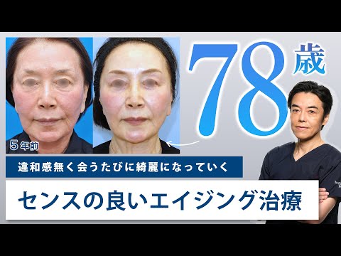 アンチエイジング】40代から始めるエイジング / 整形に見えない自然な