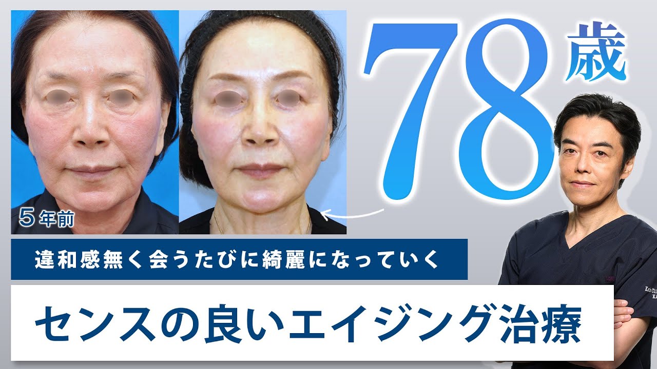 アンチエイジング】40代から始めるエイジング / 整形に見えない自然な