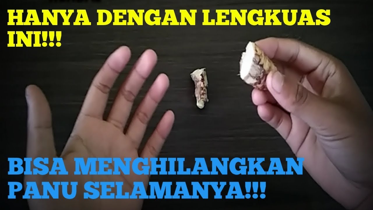 BEST TIPS  HANYA DENGAN  INI BISA MENGHILANGKAN  PANU 