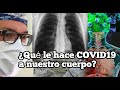 ¿Cómo actúa el virus de COVID19 en nuestro cuerpo? ¿Cómo nos enferma? por Camilo Prieto