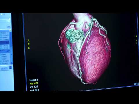 Cardiac Screening Test | Your heart health matters | Apollo One - video from Apollo Clinic