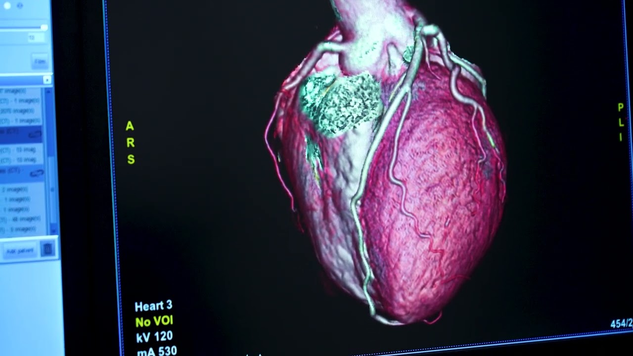 Cardiac Screening Test | Your heart health matters | Apollo One