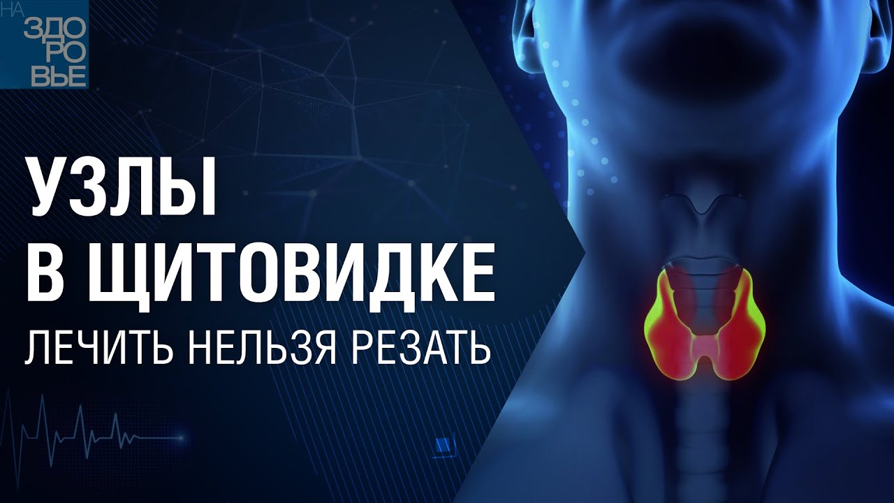 Узлы в щитовидке. Лечить нельзя резать. На здоровье 05.02.2022