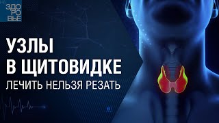 Узлы в щитовидке. Лечить нельзя резать. На здоровье 05.02.2022