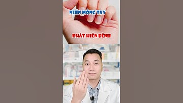 Móng tay của bạn có màu gì  #shorts #duocsitongduc