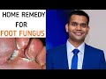 ROMOVE FOOT AND TOENAIL FUNGUS | SIMPLE HOME REMEDY