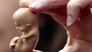 Жасанды түсік түбімізге жетпей ме? Бүгін 15:00-де 