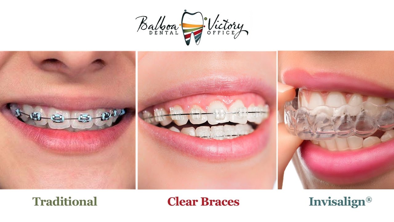 Encino Braces | Invisalign | Orthodontics