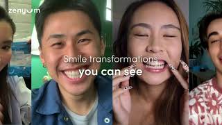 Zenyum Invisible Braces  Visible Results