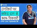 90 recovery from vitiligo on fingers  opd live  episode 38   9599794433  kayakalp global