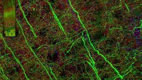 Resolution of individual synapses in cerebral cortex by high-throughput array tomography