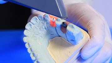 Scan Bodies | Enamel Pearls