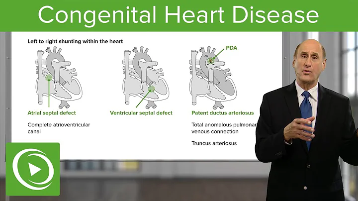 Congenital Heart Disease – Cardiology | Lecturio - DayDayNews