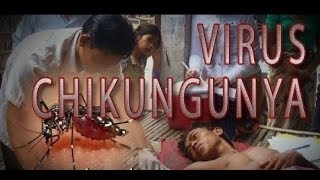La Fiebre Del Chikungunya - Síntomas y Tratamiento