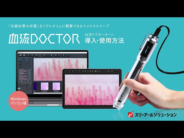 毛細血管スコープ3R（スリーアールソリューション）オートフォーカス 毛細血管スコープ3R（スリーアールソリューション）オート