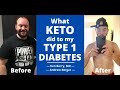 What KETO did to my Type 1 Diabetes!