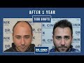 Dr. Cinik Clínica de trasplante capilar | Hair Transplant | Dr. Emrah Cinik