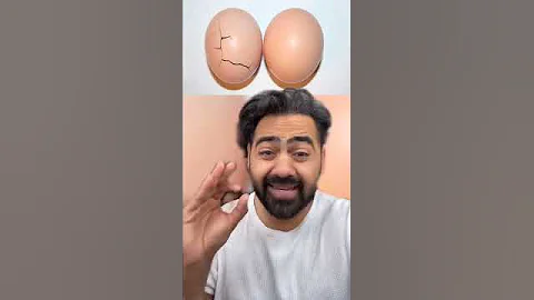 Childbirth vs kick to nuts! #shorts