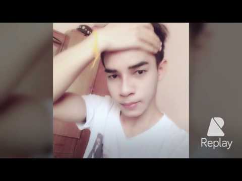 เสริมจมูกหมอบุญถิ่น ก่อนทำและหลังทำ3 (20 วัน)