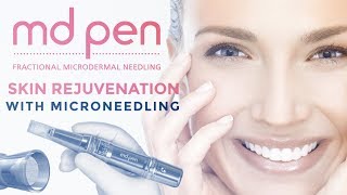 MD Pen Skin Rejuvenation With MicroNeedling on the EC! 