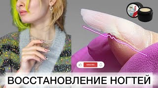 СЛАБЫЕ НОГТИ | КОРЕКЦИЯ ВЕРХНИЕ ФОРМЫ #маникюр2024 #укреплениетонкихногтей #технологияверхниеформы