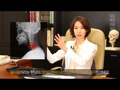 너무 아파요!!   쉴수도 없어요..   원인부터 해결까지..   “일자목의 모든것!”  How To Restore Your Healthy Neck Curve