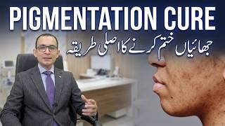 Stop Using Whitening Creams! - Skin Pigmentation Treatment & Prevention Tips