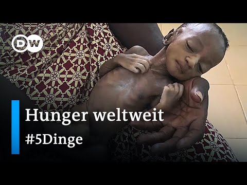 Video: Warum ist Afrika unterernährt?