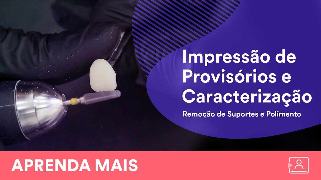 Impressão de dentes provisórios e caracterização (Parte 1)