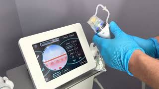 видео: Аппарат Микроигольчатый рф лифтинг, фракционный, иглы с золотым напылением, модель SECRET картинка: Аппарат Микроигольчатый рф лифтинг, фракционный, иглы с золотым напылением, модель SECRET