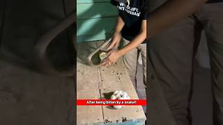 S.319||Never Do this in Snake Bite!!#shorts,#shortvideo,#healthtips,#snakebite,#drmohofilmondal..