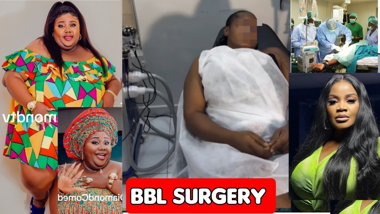 Операция пошла не так! Актриса Нолливуда Тесси Даймонд: её злые фанаты запугали её, иди на операц...