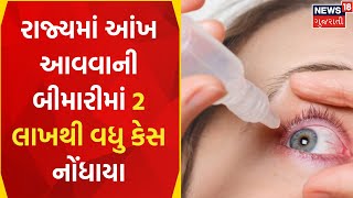 Gujarat News : રાજ્યમાં આંખ આવવાની બીમારીમાં 2 લાખથી વધુ કેસ નોંધાયા | Eye Flu | News18 Gujarati