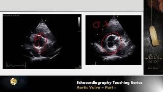 Lecture 9 - Aortic Valve Part 1
