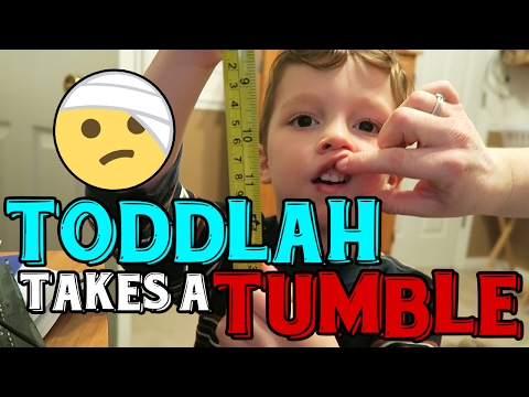 toddlah-takes-a-tumble-|-vlog-#190-|-february-8-9-|-2017