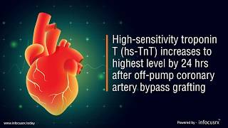 High-Sensitivity Troponin T Levels Peak At 2 Hours Post-Coronary Artery Byp Grafting.