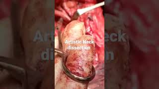 artistic neck dissection