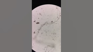 urine crystals under the microscope #laboratory #microscope #mls #cls #medtechstudent  #urinalysis