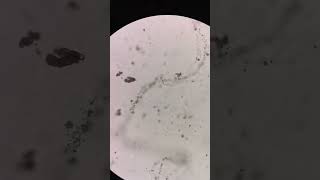 urine crystals under the microscope #laboratory #microscope #mls #cls #medtechstudent  #urinalysis