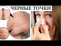 Как избавиться от черных точек - корейская косметика | Dasha Voice