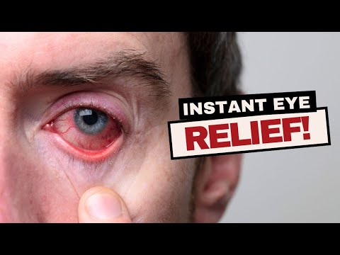 Instant Relief for Dry, Tired Eyes!