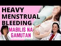Heavy menstrual bleeding mabilis na gamutan  by dr carol taruc and doc liza